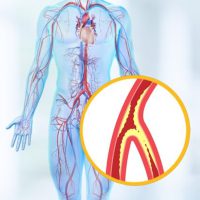 Vascular-Therapies